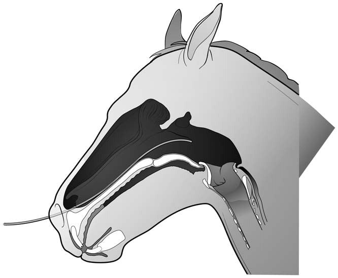 Airway